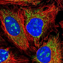 BTBD14A Antibody, Novus Biologicals 0.1mL; Unlabeled:Antibodies, Polyclonal